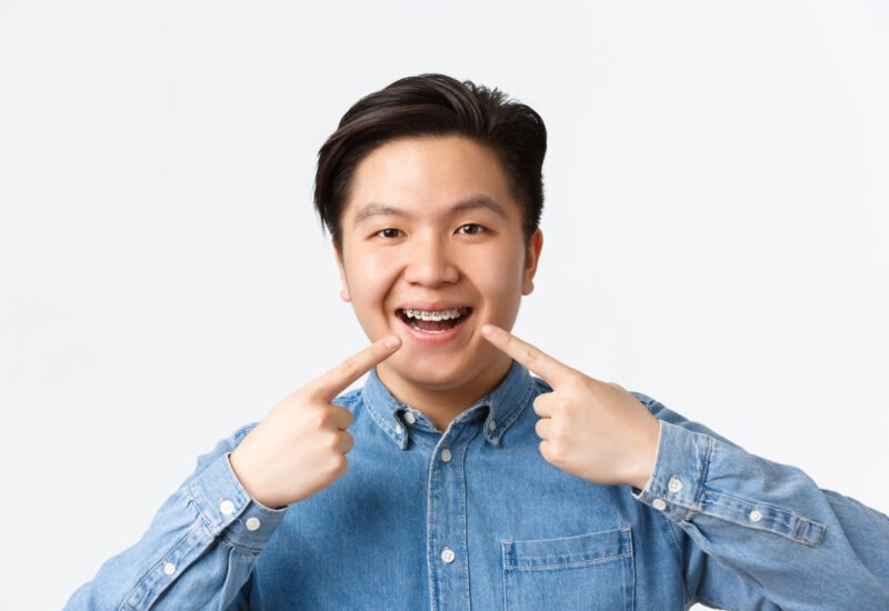 orthodontics stomatology concept close up happy smiling asian man pointing fingers dental braces teeth with pleased expression recommend dentist clinic standing white wall scaled