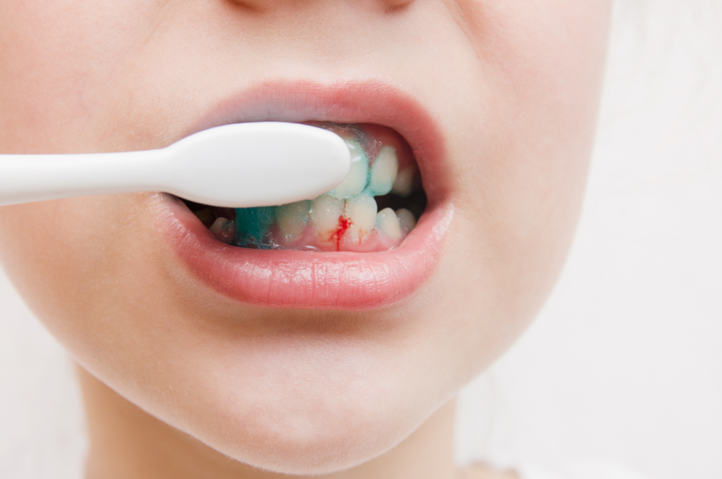bleeding gums treatment kuala lumpur